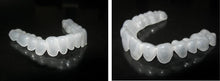Load image into Gallery viewer, KOR whitening custom trays-upper &amp; lower arch
