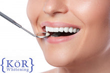 Load image into Gallery viewer, KOR whitening custom trays-upper &amp; lower arch
